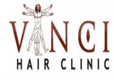 Vinci Hair Clinic Madrid